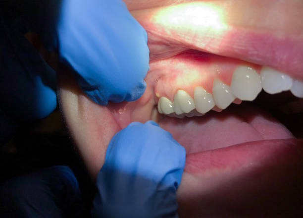 Best Emergency Dental Surgery in Como, MS